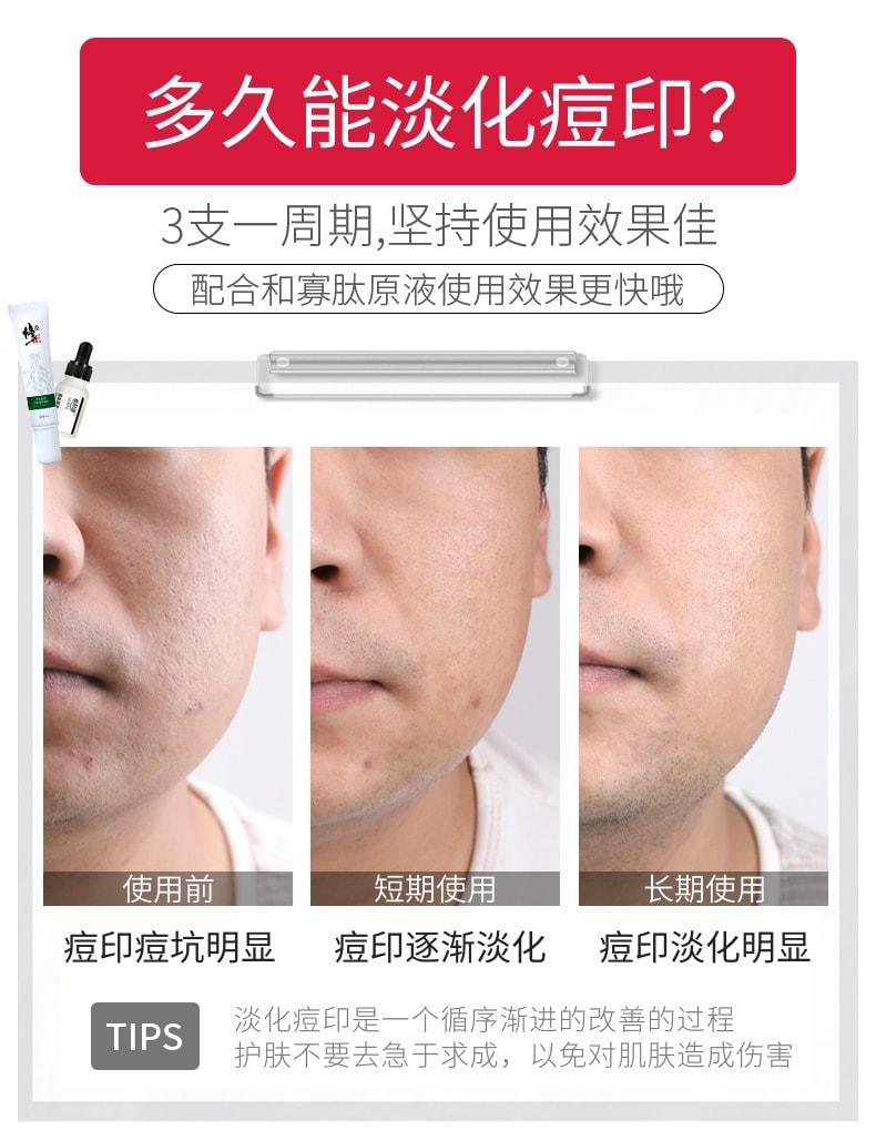 【中國直郵】修正 去痘印淡化痘坑祛痘膏 20g