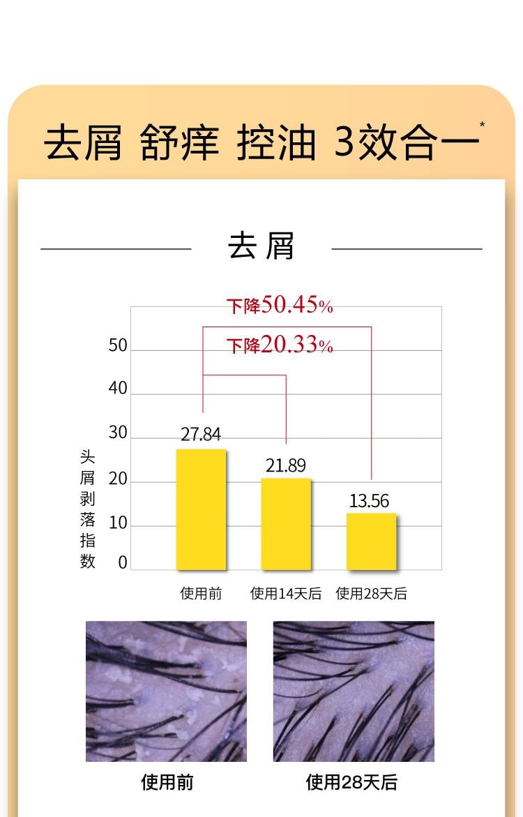 【中国直邮】 John Jeff 二硫化硒洗发水300g 去屑舒痒 告别油扁塌 三效合一