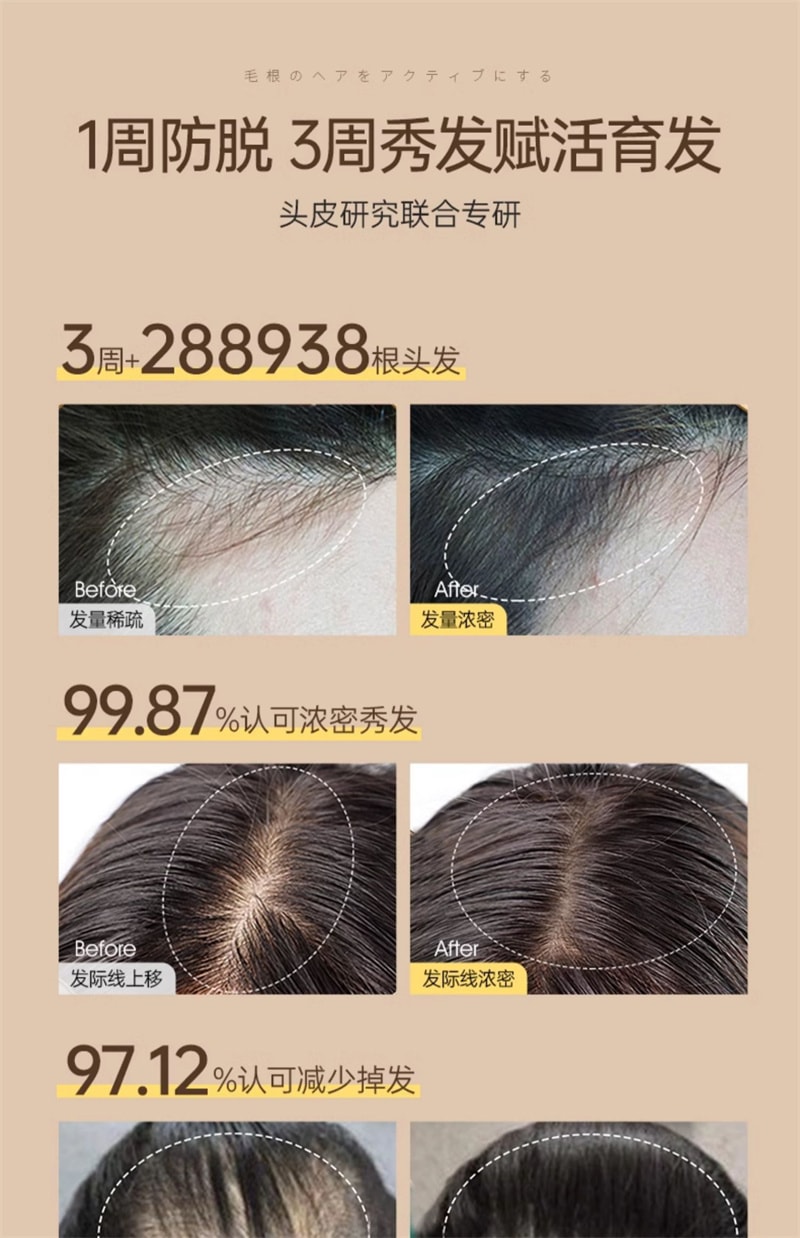 【中國直郵】 儒意 蔓濃烏發育髮液 頭髮際線營養劑發增密快速增長多男女生防脫神器 100ml/瓶(2瓶裝)