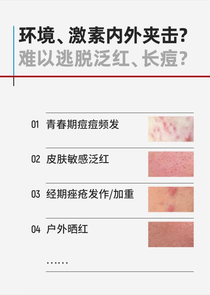 芙清 FulQun 修红祛痘次抛精华液 1.5ml*30支