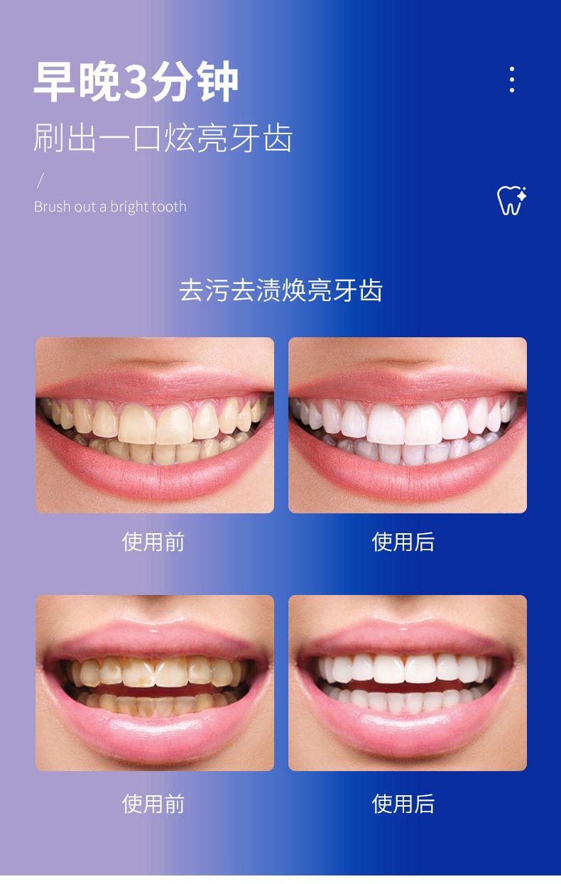【中國直郵】修正黃金版香口牙膏 150g