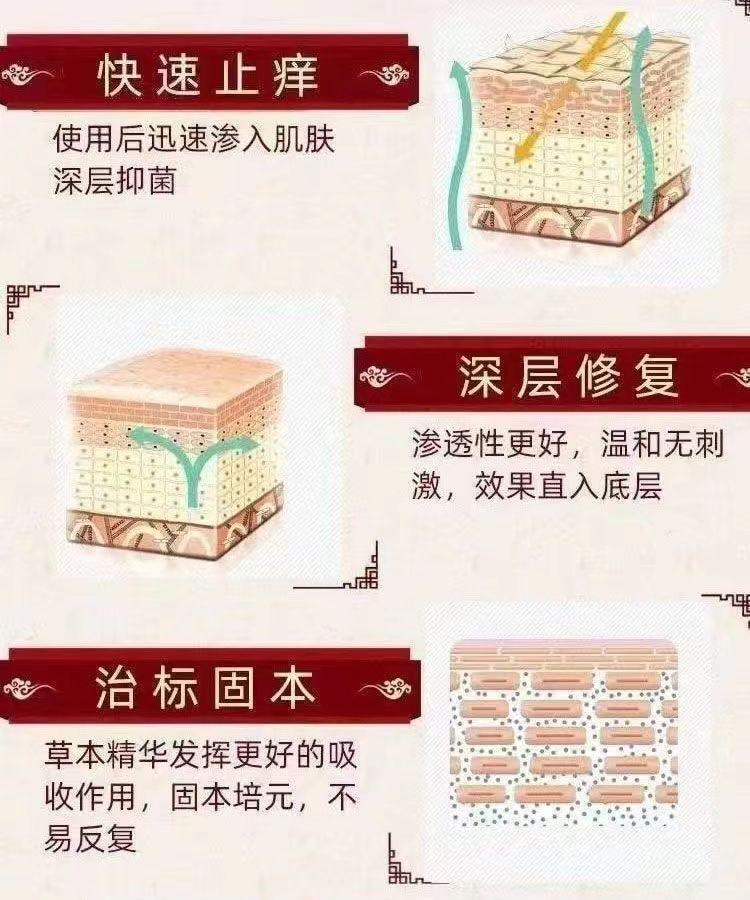 【中国直邮】 正泰林 肛痒膏 20g/支 肛周潮湿 红肿 疼痛 瘙痒难忍 肛门湿痒止痒膏