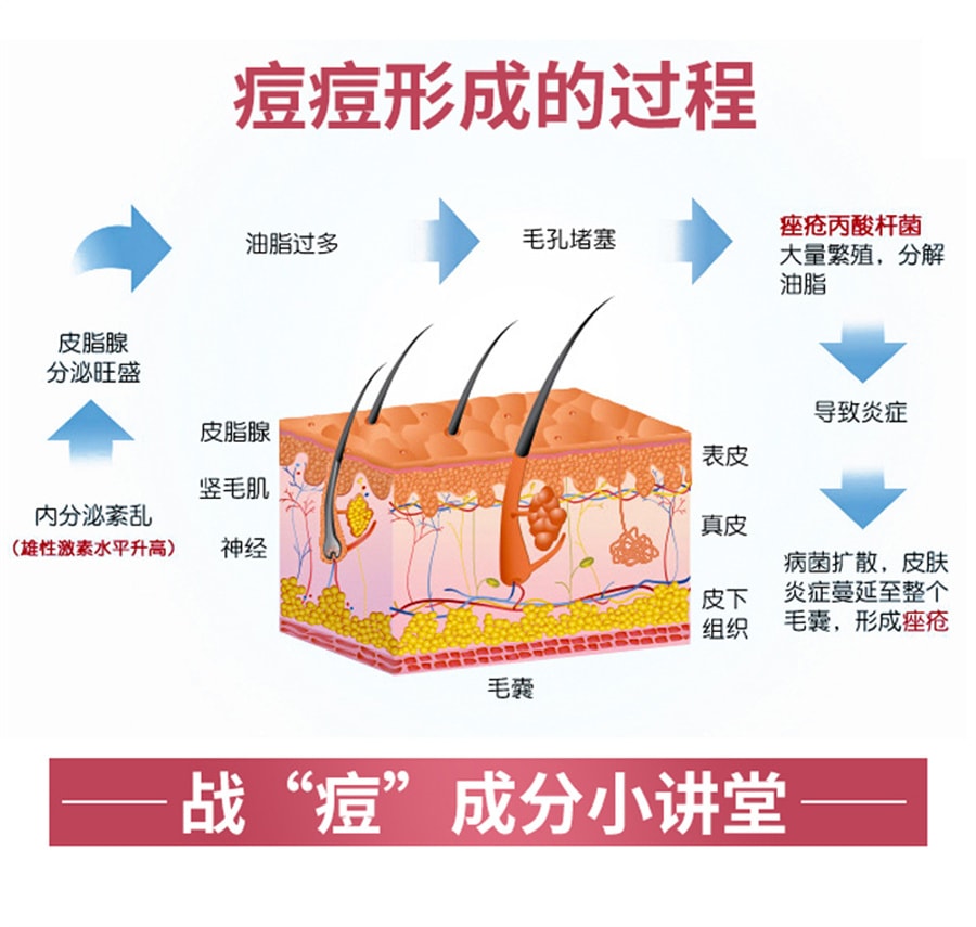 【中国直邮】良济 玫芦消痤膏祛痘痤疮痘疤湿疹青春痘皮肤瘙痒苗药 15g