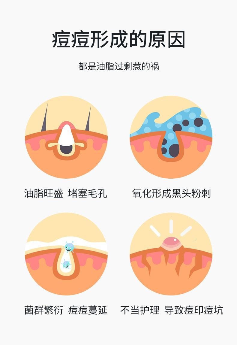【中国直邮】仁和 收细毛孔水杨酸多效祛痘膏 30g