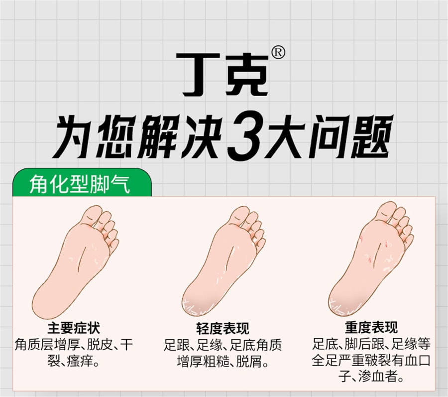 美国 丁克 盐酸特比萘芬喷雾剂去脚臭治脚气止痒脱皮杀菌股藓汗斑专用药15ml*2瓶 x 1盒