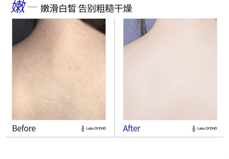 【中国直邮】 EHD 美白沐浴露 烟酰胺全身美白沐浴乳液清洁全身果酸男女 500ml